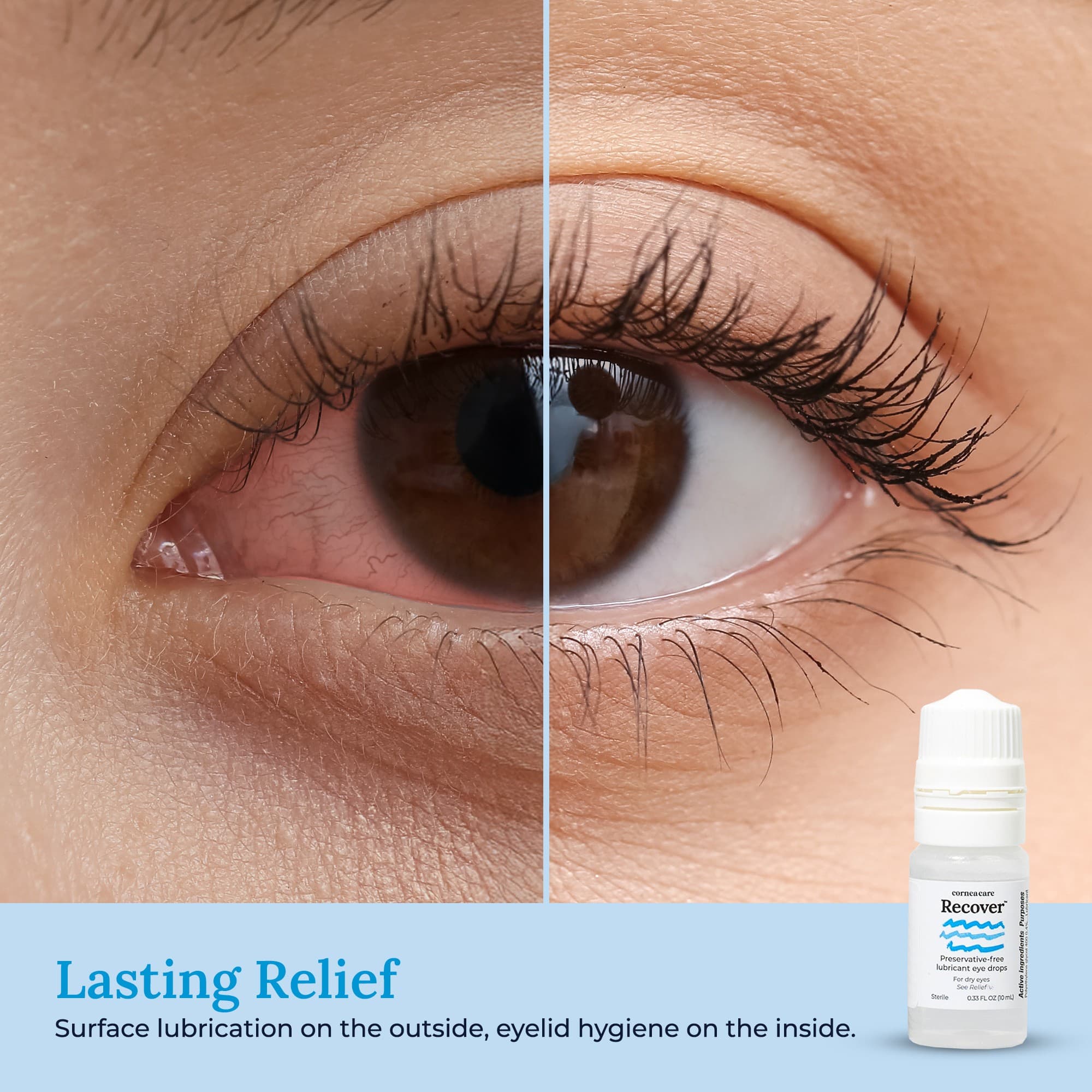 Recover-Preservative-Free-Artificial-Tears-Eye-Photo.jpg